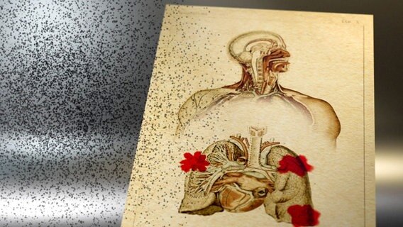 Zeichnung zeigt schematisch vergrößerten Feinstaub und die menschliche Lunge. © NDR/Christiane Schuhbert TV 