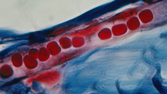 Ader mit roten Blutkörperchen © picture alliance Foto: P.Arnold, Inc./Helga Lade