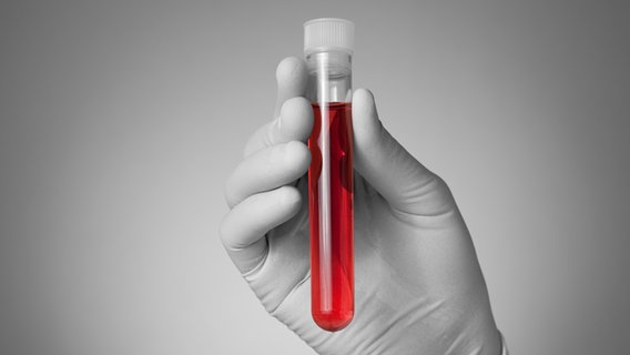 Eine Probe einer roten Flüsigkeit wird in einem Reagenzglas gehalten. © colourbox Foto: Csaba Deli