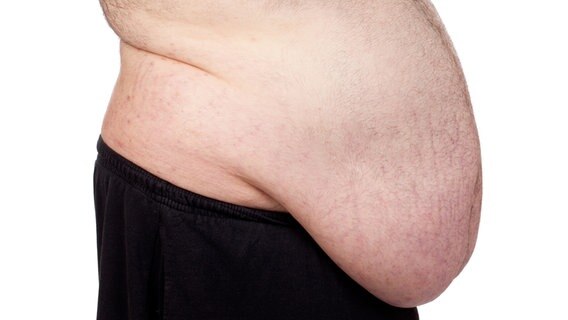 Ein Mann mit einem sehr dicken Bauch © Colourbox Foto: Gelpi