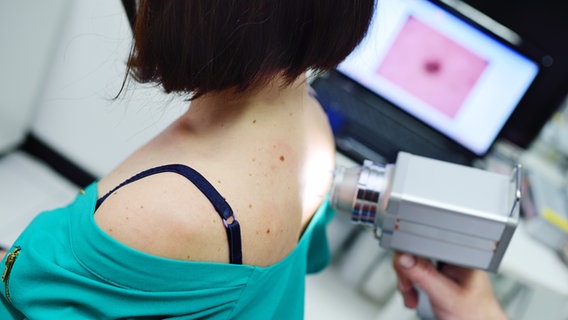 Ein Dermatologe untersucht mit einem Auflichtmikroskop den Rücken einer Patientin. © Colourbox Foto: Jan Sluimer