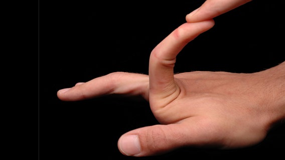 Eine Person zeigt seinen überdehnten Zeigefinger, das Ehlers-Danlos-Syndrom © panthermedia Foto: Stephan Klapszus