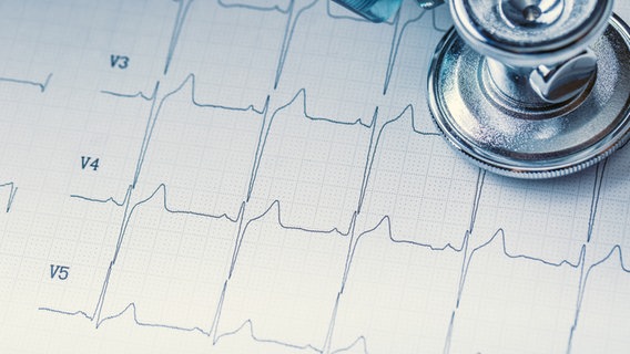 Kurven eines EKG Photo: weyo