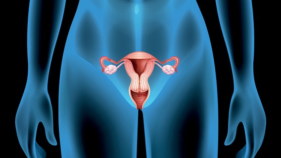 Schematische Darstelleung einer Gebärmutter © colourbox 