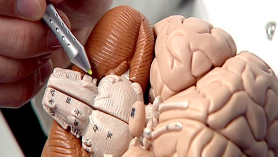 Arzt zeigt eine Gehirnregion an einem Modell © NDR 
