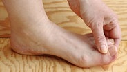 Fuß mit einem geschwollenem Zeh. © Colourbox Foto:  Astrid Gast