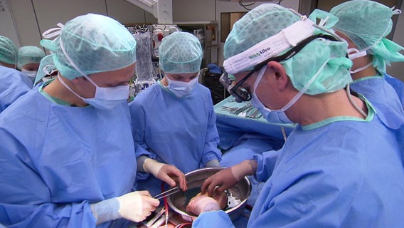 Operationsteam bei einer Herztransplantation © NDR 