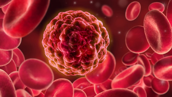 Grafik einer Krebszelle zwischen roten Blutkörperchen © Fotolia.com Foto: psdesign1