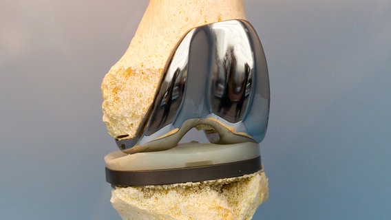 Detail shot of an artificial joint.  © Colourbox Photo: -