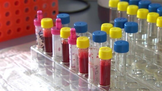 Blutproben in einem Labor © NDR 