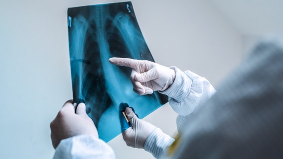 Ärzte begutachten ein Röntgenbild einer Lunge. © Colourbox Foto: -