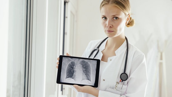 Eine junge Ärztin hält ein Tablett mit einem Rötgenbild einer Lunge in die Kamera. © imago images Foto: Westend61