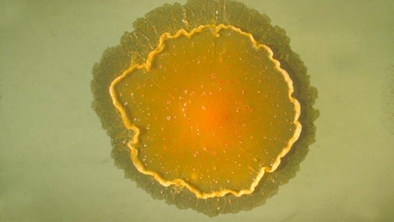 Mycobacterium marinum ist ein Stäbchenbakterium aus der Familie Mycobacteriaceae. © https://commons.wikimedia.org 