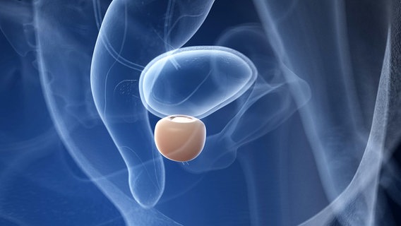Illustration einer Prostata © imago images/Science Photo Library 