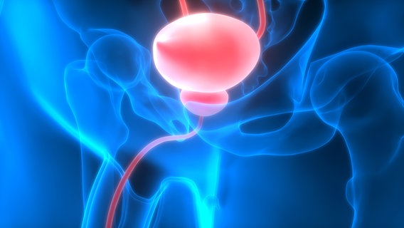 vergrößerte prostata medikamente test prima etapă a prostatitei
