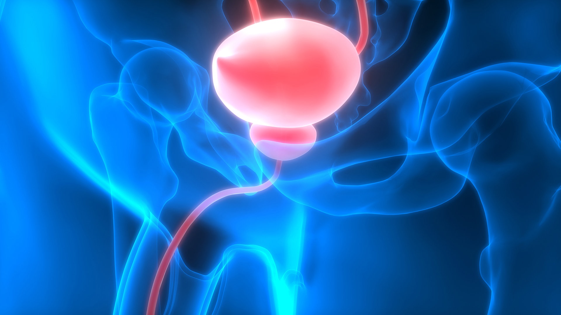 prostataadenom operative therapie scapa chiar si de prostatita