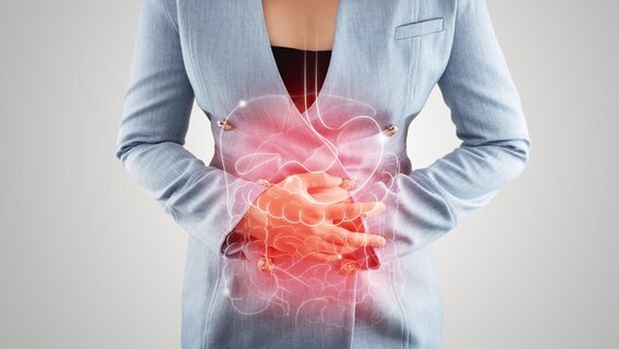 Eine Frau hält sich den Bauchbereich, auf dem ein Magen-Darm-Trakt-Grafik zu sehen ist. © Colourbox 