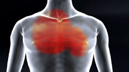 Herzinfarkt: Der Schmerz strahlt in der Brustkotb aus (Grafik) © NDR 