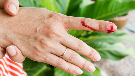 Von einem verletzten Finger tropft Blut. © Colourbox Foto: Bugtiger