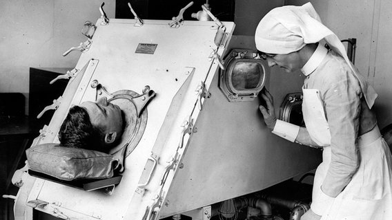 Ein Patient liegt in einer Eisernen Lunge. © picture alliance / IMAGNO/Austrian Archives 