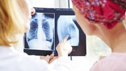 Eine Ärztin erklärt einer Patientin eine Röntgenaufnahme. © picture alliance / BSIP Foto: Alice S.