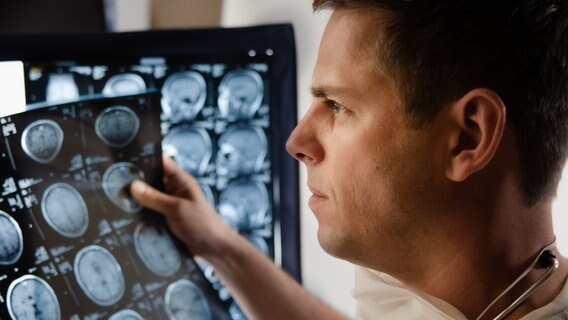 Junger Arzt blickt auf ein Röntgenbild © plainpicture/es Foto: Michele Constantini