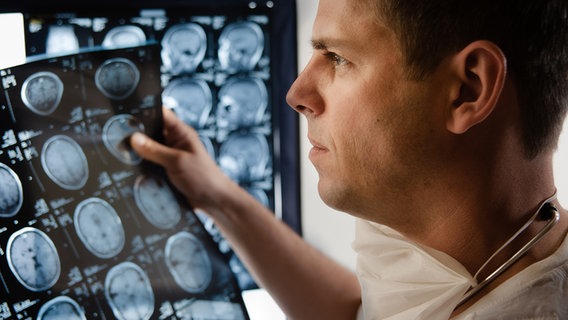 Ein Arzt betrachtet CT-Aufnahmen eines menschlichen Kopfes. © fotolia.com Foto: pix4U