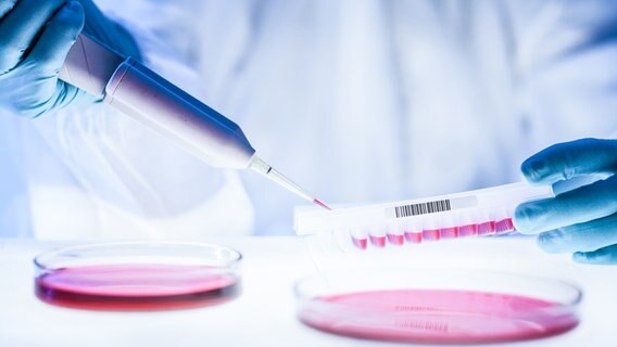 Eine Person arbeitet im Labor an einem Test © Colourbox Foto: -