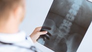 Ein Arzt hält eine Röntgenaufnahme einer Hüfte in der Hand. © Colourbox Foto: Syda Production