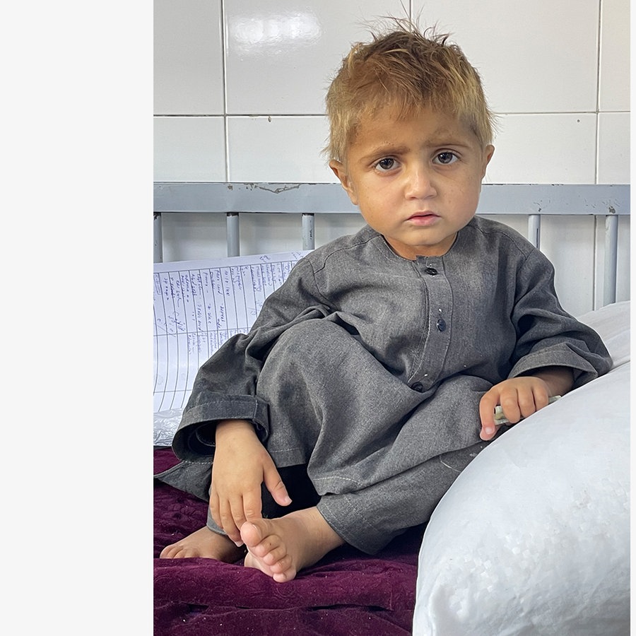 Ein unterernährter, kranker Junge im Kinderkrankenhaus von Kabul © NDR Foto: Peter Hornung