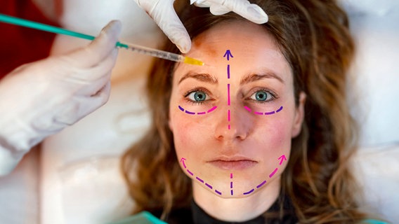 Eine Frau liegt mit aufgezeichneten Linien im Gesicht in einem ärztlichen Behandlungsstuhl. ©  NDR 