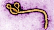 Ein Ebola-Virus unterm Mikroskop. © picture alliance / dpa | Frederick A. Murpy / Cdc Handout Foto: Frederick A. Murpy / Cdc Handout