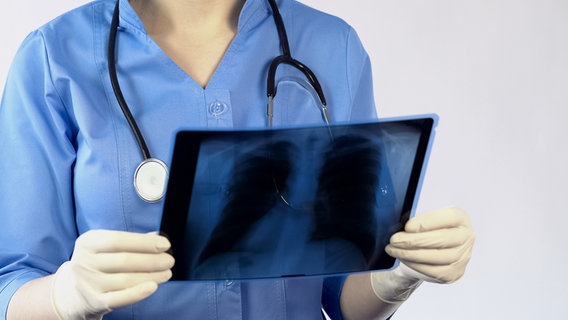 Eine Ärztin betrachtet eine Röntgenaufnahme einer Lunge © Colourbox 