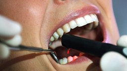 Behandlung beim Zahnarzt © dpa Bildfunk © DPA Bildfunk 