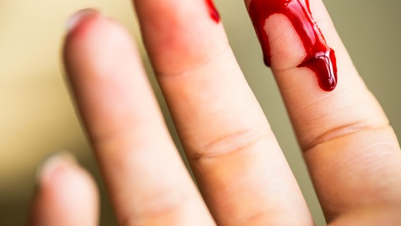 Blut läuft am Finger runter. © Annebel146 / photocase.de Foto: Annebel146 / photocase.de