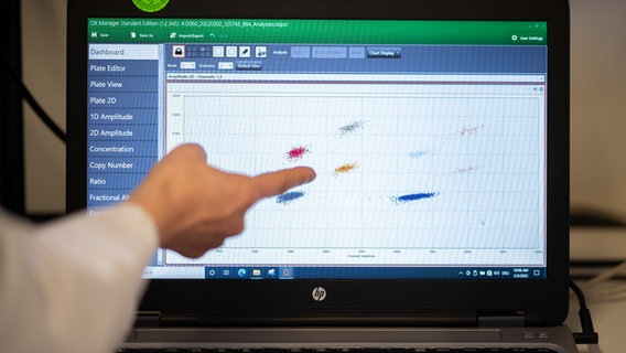 Eine Probenauswertung einer Abwasserprobe mit Nachweisen auf Virusgene des SARS-CoV-2 Virus sind im Institut für Hygiene und Gesundheit in einem Labor auf einem Monitor zu sehen. © picture alliance/dpa Foto: Daniel Reinhardt