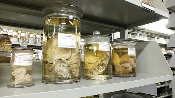 Glasbehälter mit Tote Mannshänden im Zoologischen Museum Hamburg  Foto: Marc-Oliver Rehrmann