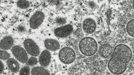 A 2003 electron micrograph provided by the Centers for Disease Control and Prevention shows oval-shaped mature monkeypox viruses (l) and spherical-shaped immature virions.  © CDC/AP/picture-alliance Photo: Russell Regner