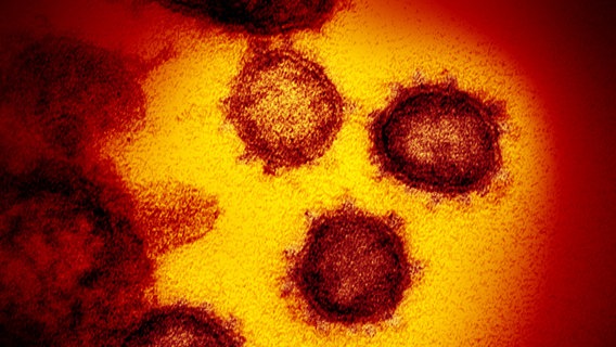 Elektronenmikroskopische Aufnahme des neuartigen Coronavirus SARS-CoV-2. © picture alliance/NIAID-RML/AP/dpa 