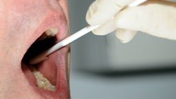 Mit einem Abstrichstäbchen wird eine DNA-Probe aus dem Mund eines Mannes genommen. © dpa - Bildfunk Foto: Marcus Führer
