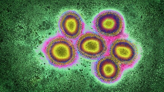 Eine Ansammlung vergrößerter und eingefärbter Grippeviren - aufgenommen mit einem Transmissionselektronenmikroskop. © picture alliance / BSIP | CAVALLINI JAMES 
