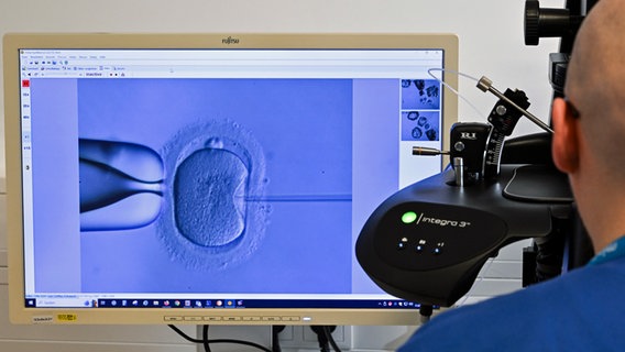 Im Zelllabor im Fertility Center Berlin wird mit Hilfe eines Elektronenmikroskops die Befruchtung einer Eizelle durchgeführt. © picture alliance/dpa | Jens Kalaene 