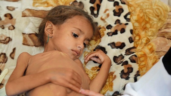 Das schwer unterernährte Mädchen Elaaf auf einem Krankenhausbett. © ARD 