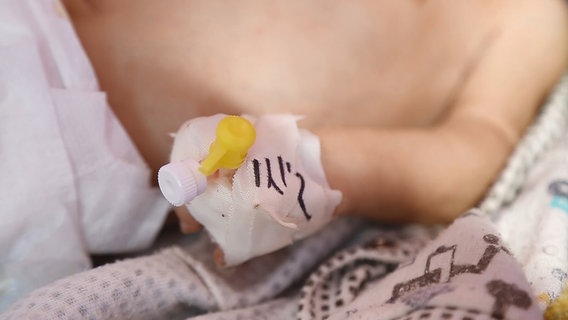 Ein Kanülenzugang am Handgelenk eines Babys. © ARD 