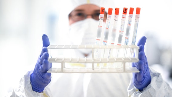 Ein Mitarbeiter eines Labors hält einen Ständer mit diversen Abstrichröhrchen in den Händen. © dpa Foto: Felix Kästle