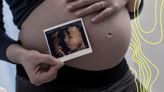 Eine schwangere Frau steht am 24.01.2018 in einer Wohnung in Bruchhausen-Vilsen (Niedersachsen) und zeigt ihr Ultraschallbild von der 3D-Ultraschalluntersuchung (gestellte Szene). © picture alliance / dpa Themendienst Foto: Christin Klose