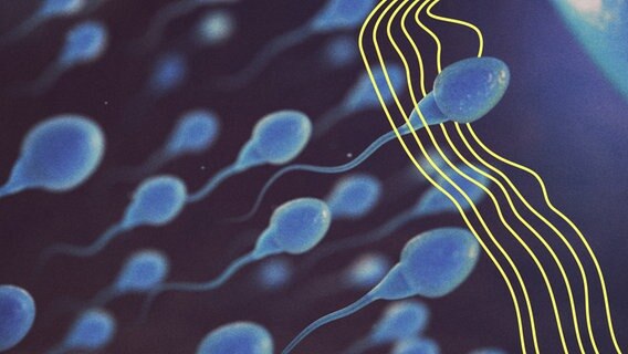 Sperma unter einem Mikroskop in Großaufnahme. © picture alliance Foto: Maksym Yemelyanov