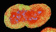 Abbildung eines Neisseria gonorrhoeae Bakteriums, auch allgemein als Tripper bekannt. © Imago/Science Photo Library 
