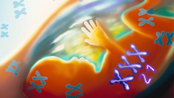 Ultraschallaufnahme eines Embryos. © picture alliance Foto: BSIP