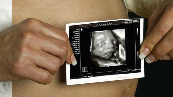 Eine schwangere Frau hält eine Ultraschallaufnahme des Embryos vor den Bauch. Eine schwangere Frau hält eine Ultraschallaufnahme des Embryos vor den Bauch. © dpa picture alliance/blickwinkel Foto: M. Stolt